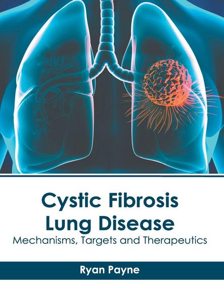 Produktbild: Cystic Fibrosis Lung Disease: Mechanisms, Targets and Therapeutics