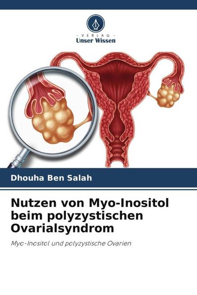 Nutzen von Myo-Inositol beim polyzystischen Ovarialsyndrom, Taschenbuch von Dhouha Ben Salah, Verlag Unser Wissen, 978-620-5-30094-7