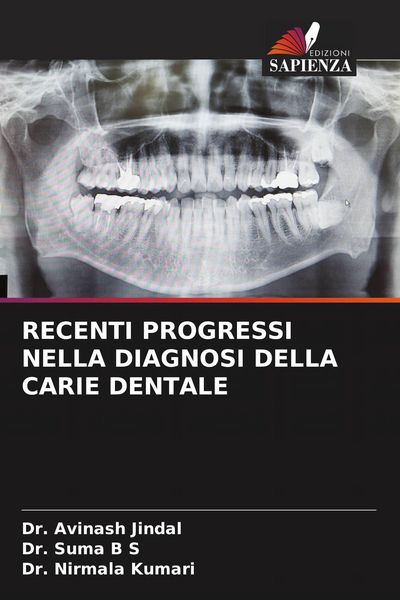 Produktbild: Recenti Progressi Nella Diagnosi Della Carie Dentale
