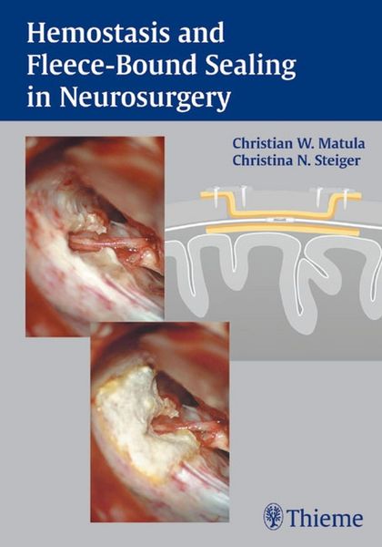 Produktbild: Hemostasis and Fleece-Bound Sealing in Neurosurgery