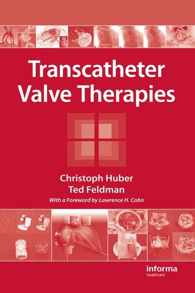 Produktbild: Transcatheter Valve Therapies