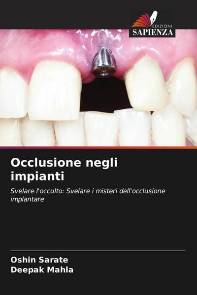 Produktbild: Occlusione negli impianti