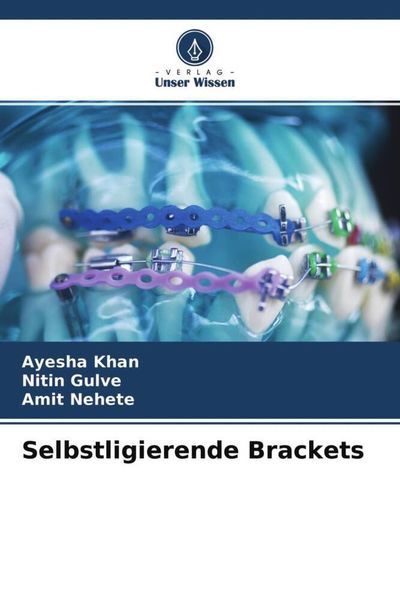 Produktbild: Selbstligierende Brackets