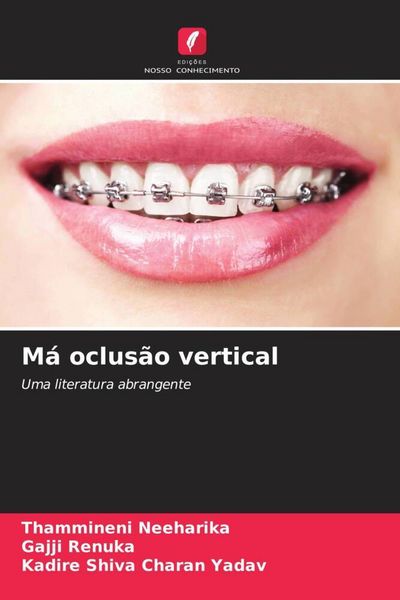 Produktbild: M&aacute; oclus&atilde;o vertical