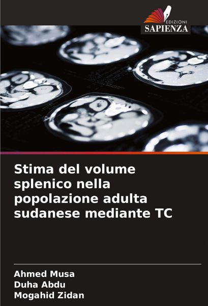 Produktbild: Stima del volume splenico nella popolazione adulta sudanese mediante TC
