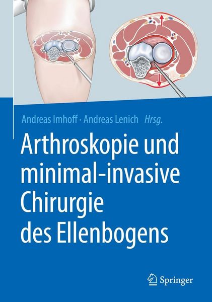 Produktbild: Arthroskopie und minimal-invasive Chirurgie des Ellenbogens