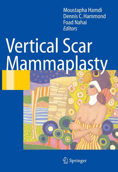 Produktbild: Vertical Scar Mammaplasty