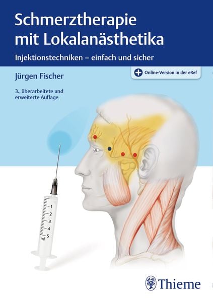 Schmerztherapie mit Lokalanästhetika, Set von Jürgen Fischer, Thieme, 9783131179333
