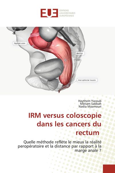 Produktbild: IRM versus coloscopie dans les cancers du rectum