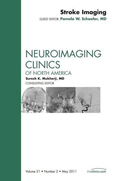 Produktbild: Stroke Imaging, an Issue of Neuroimaging Clinics