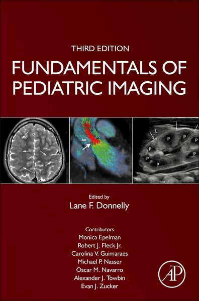 Produktbild: Fundamentals of Pediatric Imaging
