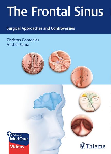 Produktbild: The Frontal Sinus