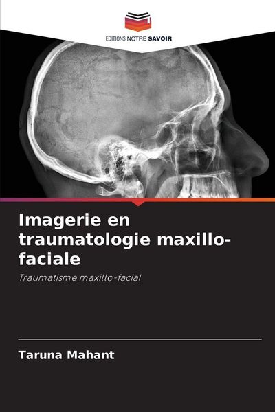 Produktbild: Imagerie en traumatologie maxillo-faciale