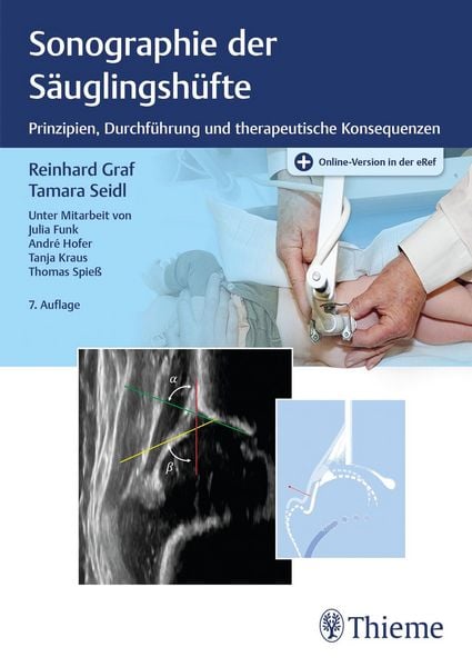 Produktbild: Sonographie der S&auml;uglingsh&uuml;fte