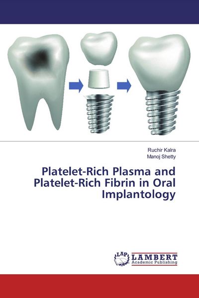 Produktbild: Platelet-Rich Plasma and Platelet-Rich Fibrin in Oral Implantology