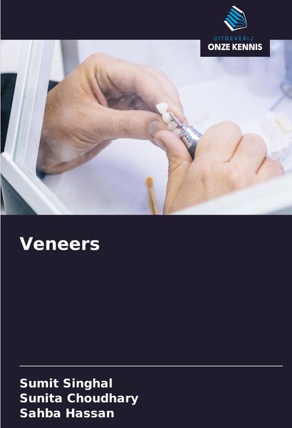 Produktbild: Veneers