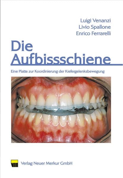 Produktbild: Die Aufbissschiene