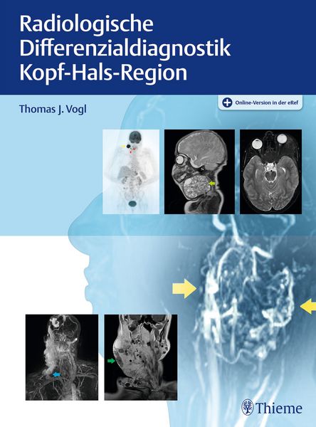 Produktbild: Radiologische Differenzialdiagnostik Kopf-Hals-Region