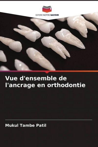 Produktbild: Vue d'ensemble de l'ancrage en orthodontie