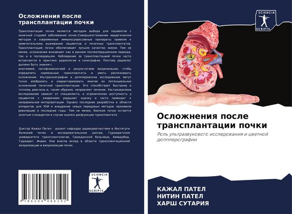 Produktbild: Oslozhneniq posle transplantacii pochki