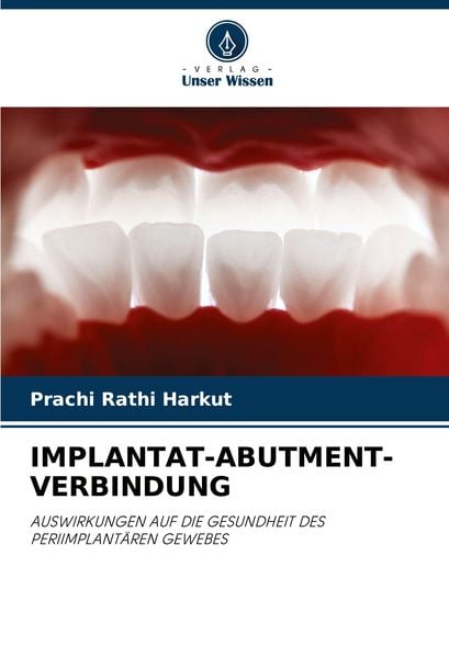 Produktbild: Implantat-Abutment-Verbindung