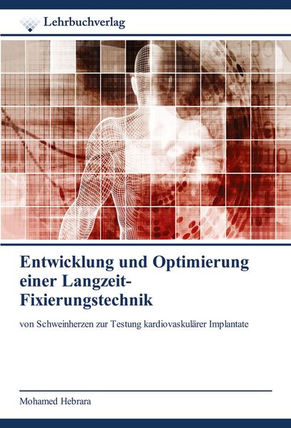 Produktbild: Entwicklung und Optimierung einer Langzeit- Fixierungstechnik