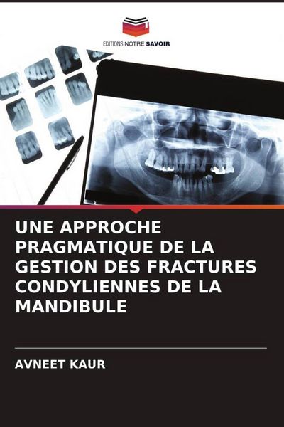 Produktbild: Une Approche Pragmatique De La Gestion des Fractures Condyliennes De La Mandibule