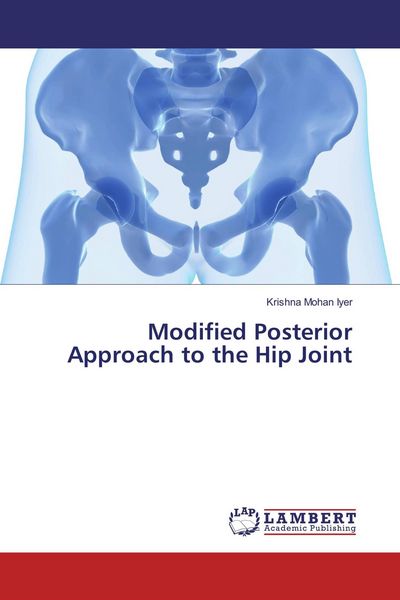 Produktbild: Modified Posterior Approach to the Hip Joint