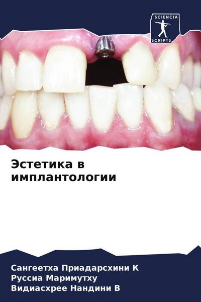Produktbild: Jestetika w implantologii