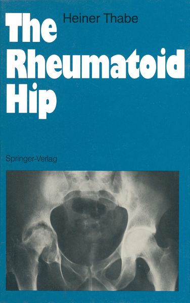 Produktbild: The Rheumatoid Hip