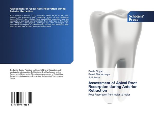 Produktbild: Assessment of Apical Root Resorption during Anterior Retraction