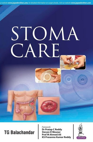 Produktbild: Stoma Care
