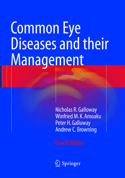 Produktbild: Common Eye Diseases and their Management