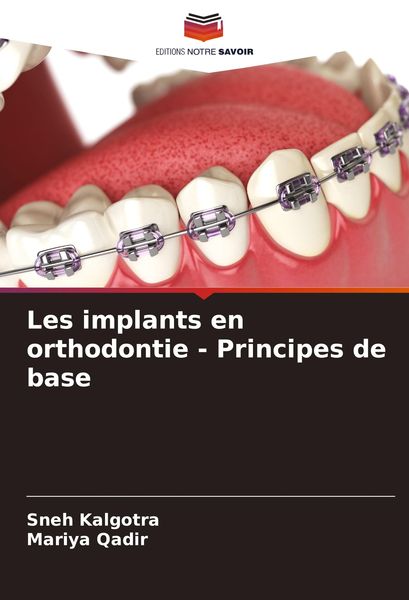 Produktbild: Les implants en orthodontie - Principes de base