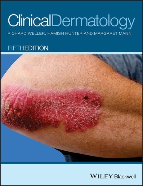 Produktbild: Clinical Dermatology 5e