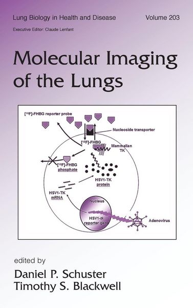 Produktbild: Molecular Imaging of the Lungs