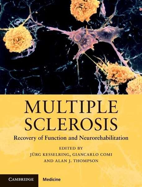 Produktbild: Multiple Sclerosis