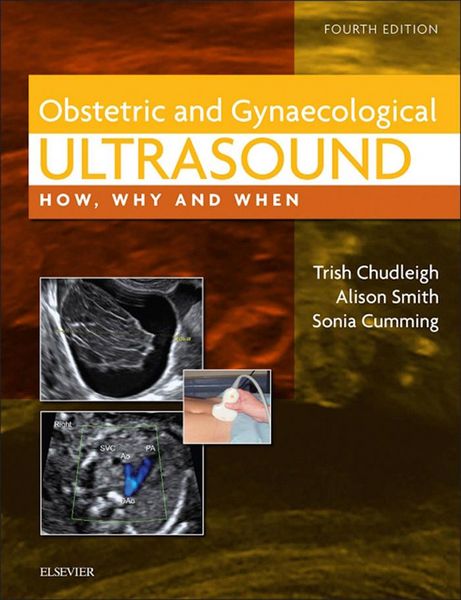 Produktbild: Obstetric & Gynaecological Ultrasound