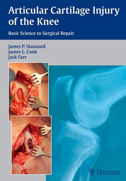 Produktbild: Articular Cartilage Injury of the Knee: Basic Science to Surgical Repair