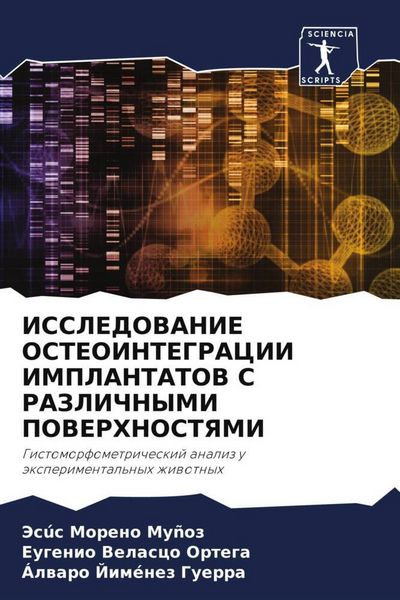 Produktbild: Issledovanie Osteointegracii Implantatov S Razlichnymi Poverhnostyami