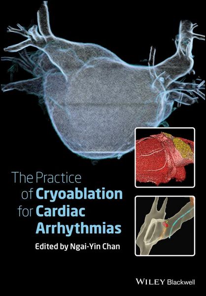 Produktbild: The Practice of Catheter Cryoablation for Cardiac Arrhythmias