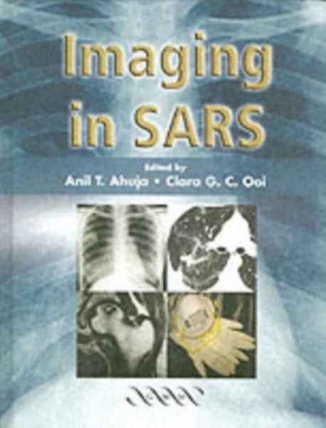 Produktbild: Imaging in SARS