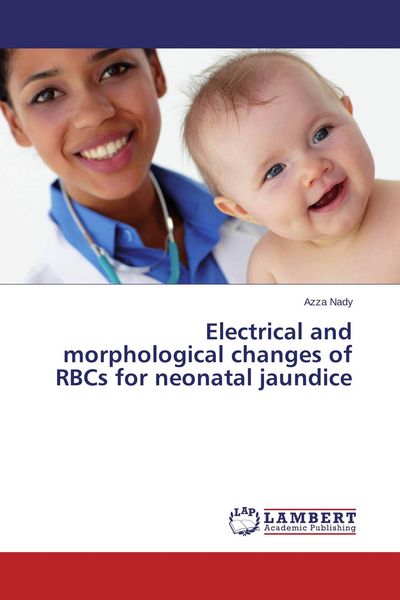 Produktbild: Electrical and morphological changes of RBCs for neonatal jaundice