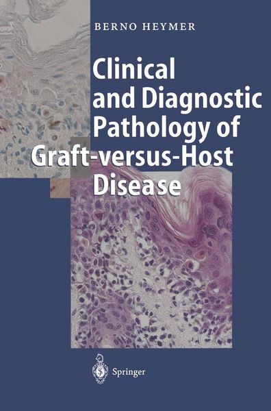 Produktbild: Clinical and Diagnostic Pathology of Graft-versus-Host Disease