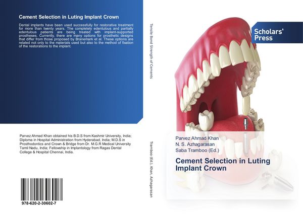 Produktbild: Cement Selection in Luting Implant Crown