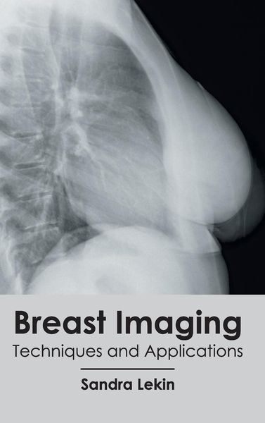 Produktbild: Breast Imaging