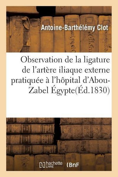 Produktbild: Observation de la Ligature de l'Art&egrave;re Iliaque Externe Pratiqu&eacute;e &Agrave; l'H&ocirc;pital d'Abou-Zabel &Eacute;gypte