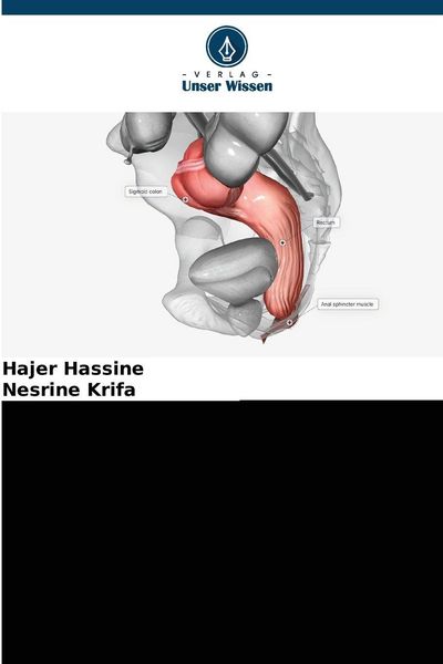 Präkanzeröse Läsionen des Anus, Taschenbuch von Hajer Hassine , Nesrine Krifa, Verlag Unser Wissen, 9786209110993