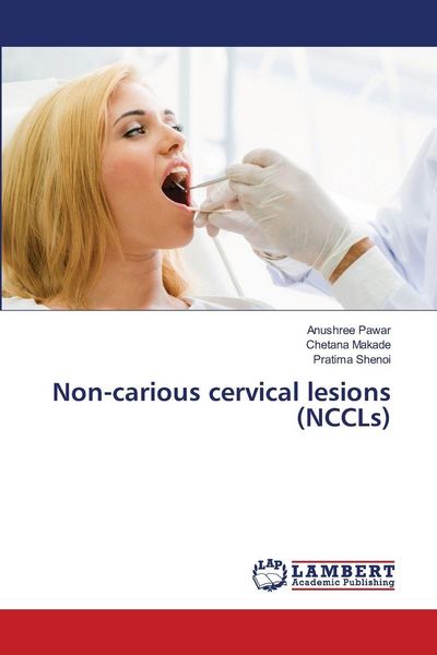 Produktbild: Non-carious cervical lesions (NCCLs)