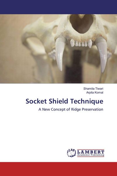 Produktbild: Socket Shield Technique